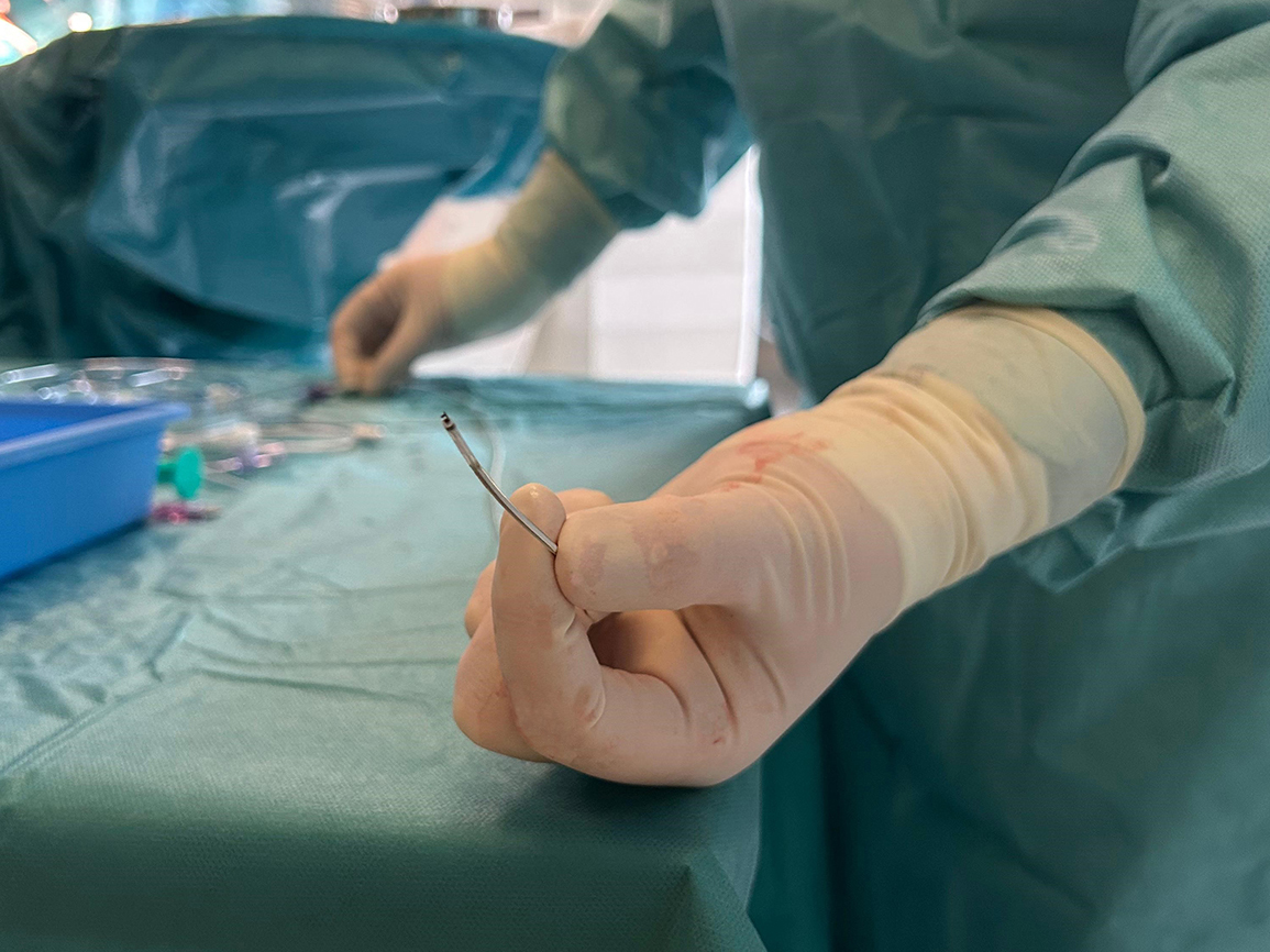 Die OmniaSecure™ Defibrillationselektrode ist eine neuartige Weiterentwicklung der Technologie transvenöser Defibrillationselektroden ist mit einem Durchmesser von rund 1,55 Millimetern vorteilhaft für den venösen Zugang.